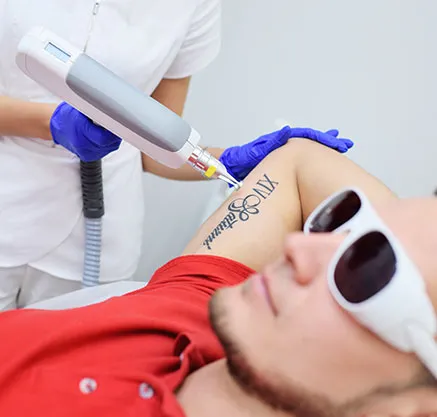 Chelsford | level 5 laser tattoo removal